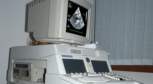 Detail of the "Agilent Hp SONOS 5500" Ultrasound System Unit Detailed image of the "Agilent Hp SONOS 5500" Ultrasound System Unit