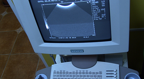 Detailed image of the Organ Ultrasound System Unit used at the Dr. Vaetisi Medical Center Detailed image of the Organ Ultrasound System Unit used at the Dr. Vaetisi Medical Center