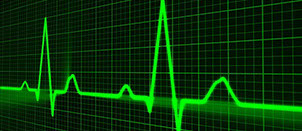 A screen-based representation of a human heart pulse A screen-based representation of a human heart pulse