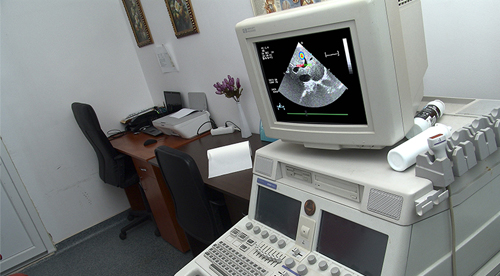 Ecographic image on the screen of the Cardiology Examination Room Ecographic image on the screen of the Cardiology Examination Room